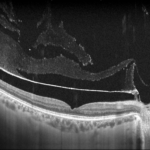 0fbbf98c-bca9-4ba7-8258-91094564f02b