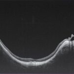 30612fcb-b1e6-4a0b-8374-0a8ebabe0e50